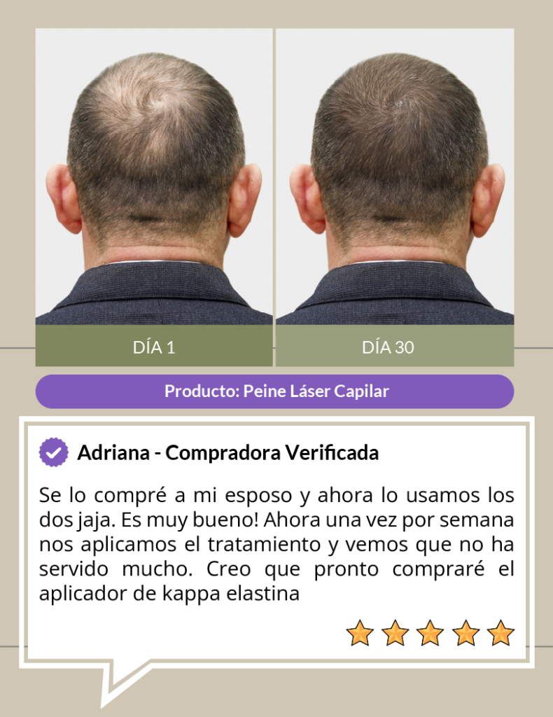 testimonio recuperación de cabello